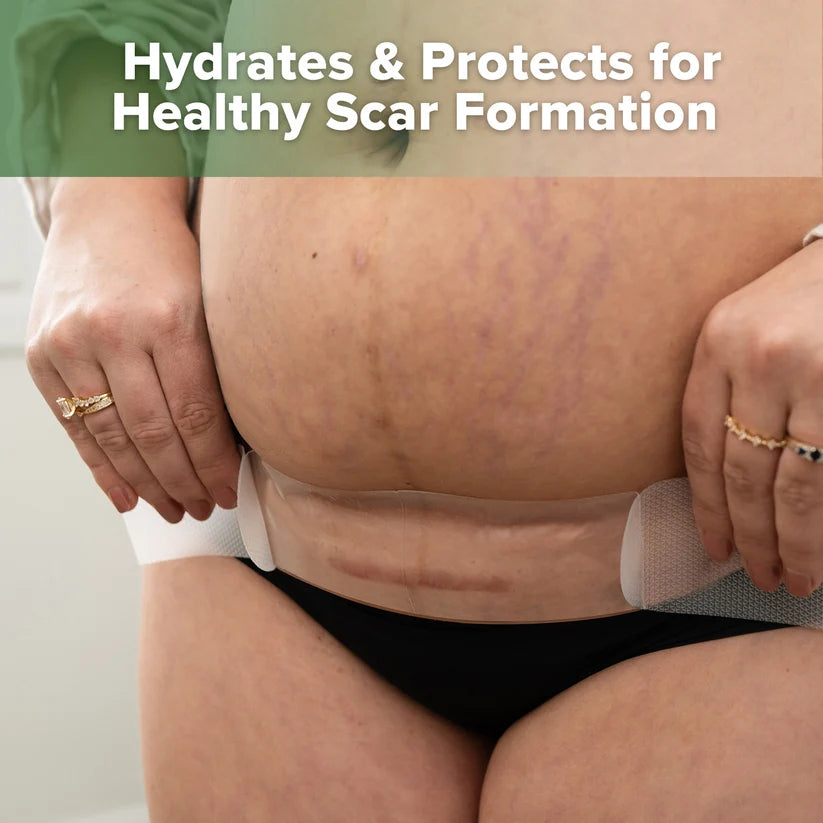 Haakaa Mum C-Section Scar Silicone Patches